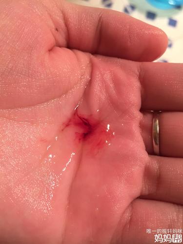 今天洗澡感觉有东西流出来,明天排卵日,这算是排卵期出血