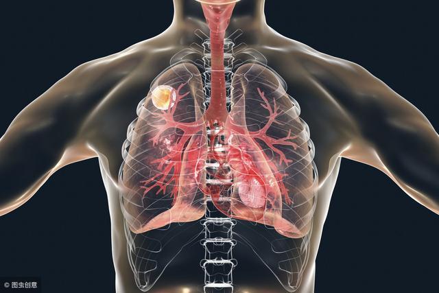 身体3处持续"喊痛", 或许肺部已癌变