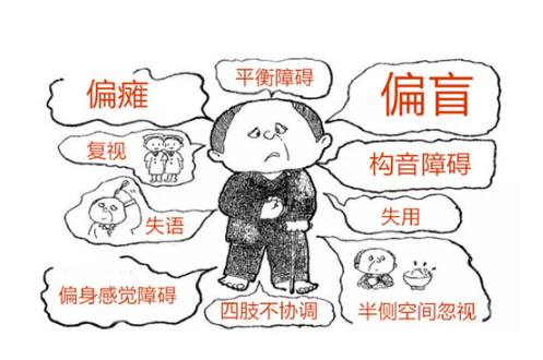 中风先兆,早了解,早预防