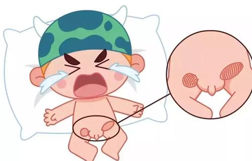 小儿疝气不能置之不理,为什么?