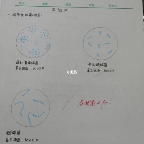 葡萄球菌,链球菌,肺炎链球菌画图及形态描述