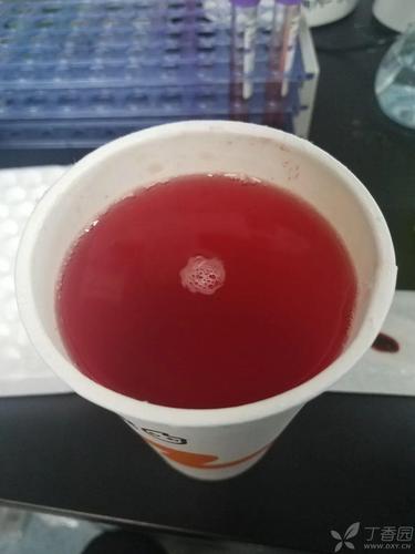 肉眼血尿,是出了多少血?