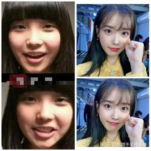 国民妹妹iu整过容吗?