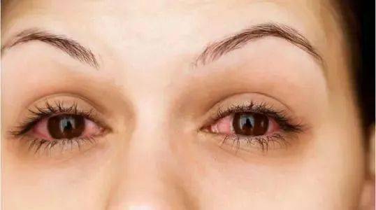 国际禁毒日 | 吸毒者眼睛的这些特征,你知道吗?