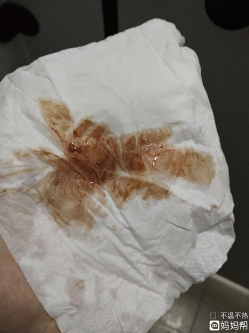 前两天只是褐色的,今天分泌物就有点血了.不是很多.有什么影响吗?