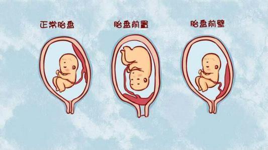 孕妈不要害怕,想要胎盘长上去,孕期做好