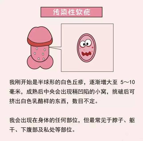 丁丁上有小疙瘩是xing病吗?