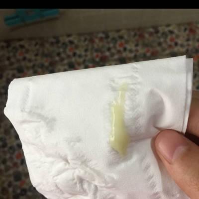 有没有哪位宝妈跟我一样,会有这种颜色的分泌物流出来.跟黄鼻涕一样.