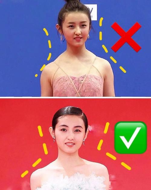 总被嘲的溜肩,斜方肌都不见了,取而代之的是标准直角肩