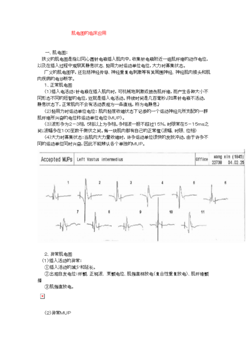 肌电图的临床应用汇总.doc