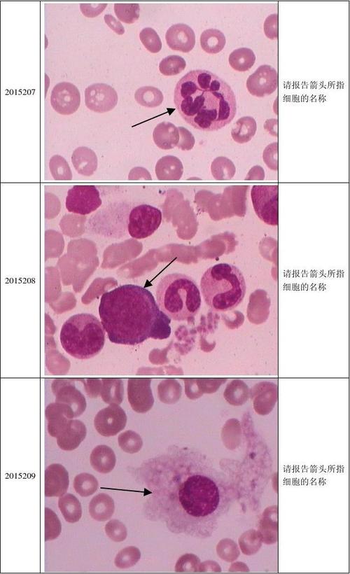 2015年第2次血细胞形态学检查室间质量评价.