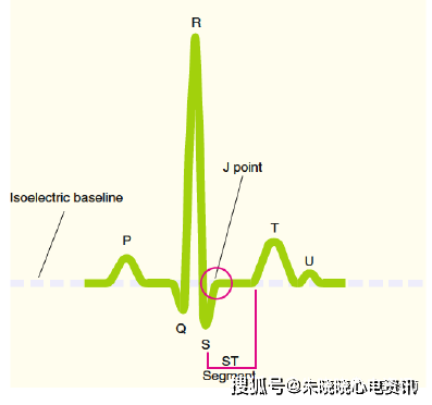 心电图"零"基础入门,干货满满!