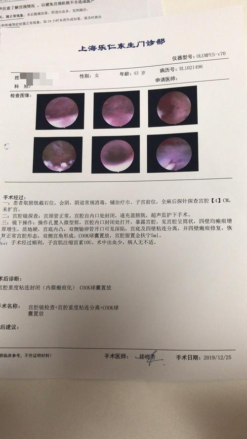 宫腔已经完全恢复正常.