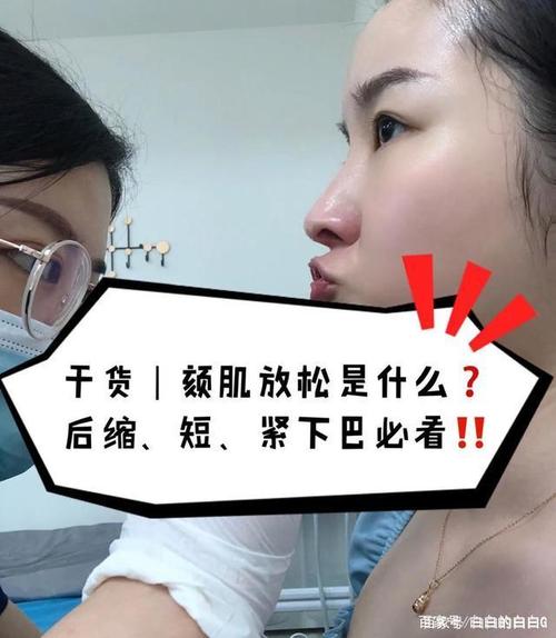 颏肌放松有什么用?值不值得做?