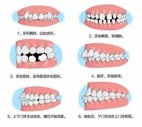 最新冬季牙列不齐公益筛查今起开放报名