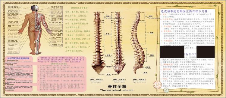 医院人体脊椎骨神经分布病变变大挂图自粘喷绘现代