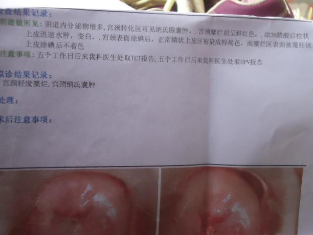 宫颈轻度糜烂和宫颈纳氏囊肿医生说要手术才可以治愈