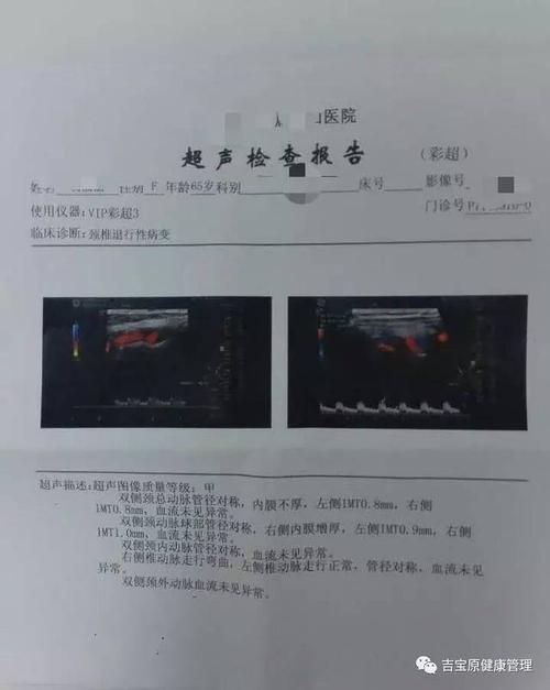 亲身经历|颈动脉堵塞,我将母亲从生死线拉回!