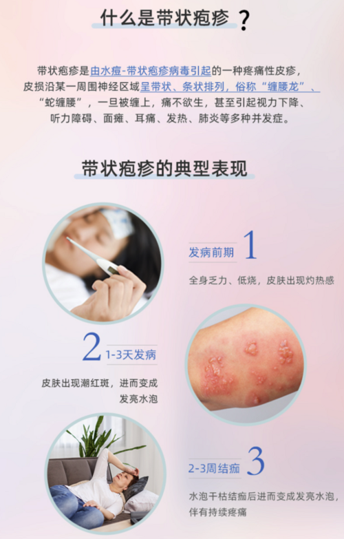 限上海全国带状疱疹疫苗生蛇2次接种预约