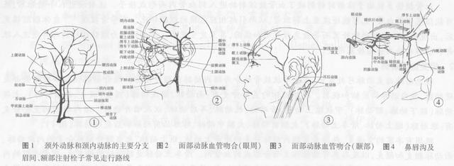 面部注射填充的血管并发症及处理对策