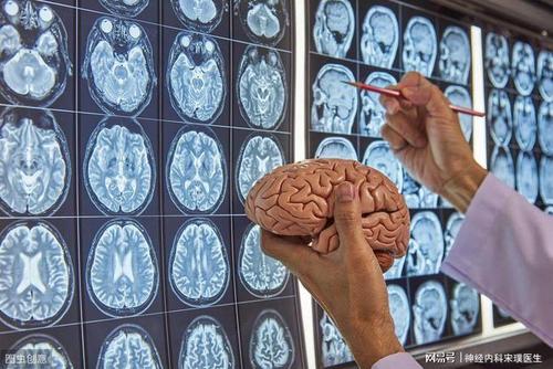 ct/磁共振报告上的"脑萎缩"到底是什么病?脑科医生为您解答