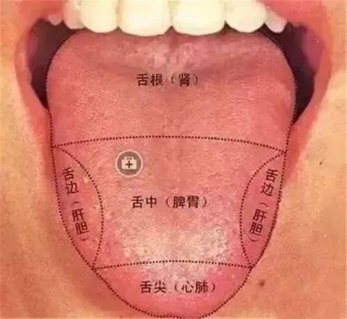 火在肺里:咳嗽;火在肝里:失眠;火在胃里:口臭;火在.