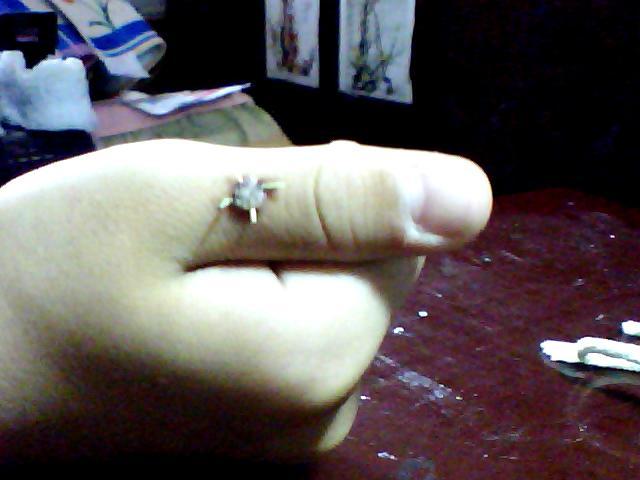 手上长刺猴了怎么治