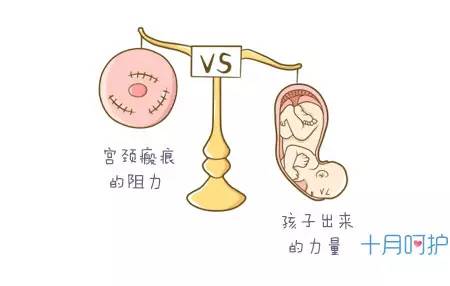 初产妇都是宫颈先缩短,等到展平了,才开始扩张.