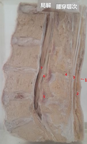 首页 临床应用-腰穿层次_副本       人体解剖学精品视频公开课