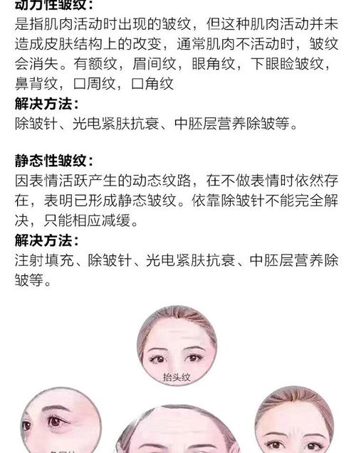 【保妥适单部位除皱针】【闺蜜同行各赠增值金500元】