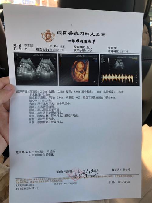 十七周今天去做的四维是男宝