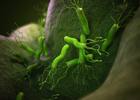 自从幽门螺杆菌被称为导致胃癌的元凶之一,又被定义为抑种