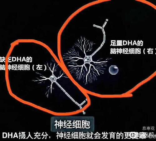 满足欧盟推荐dha水平,助力宝宝大脑发育# 大脑发育黄金期,你该为孩子