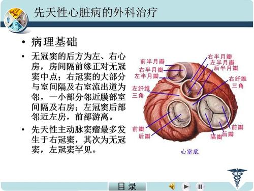 (参考课件)主动脉窦瘤破裂.ppt