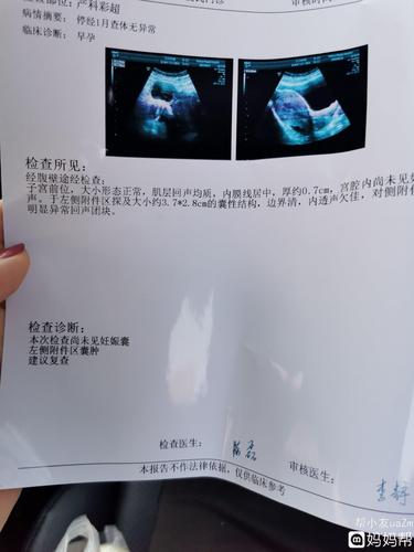明明怀孕了,为什么做彩超看不见呢