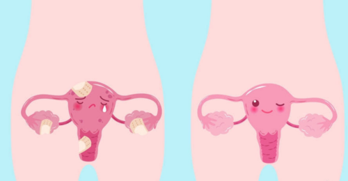 北京卵巢早衰能治好吗