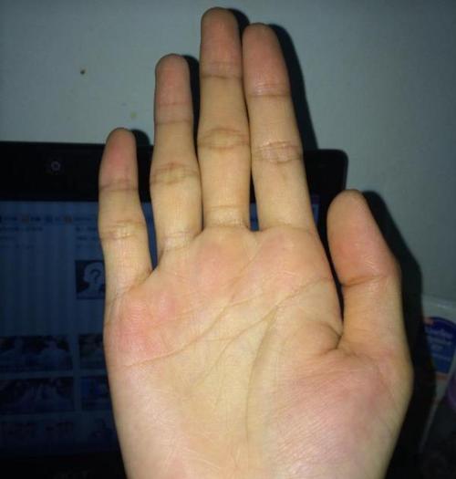 不要被蒙了,看自己手掌能发现的病,红色掌心的人注意