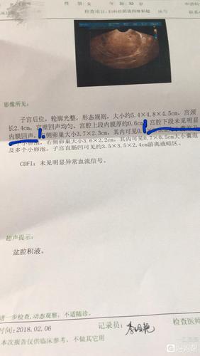会不会是宫腔粘连?我都不敢去做宫腔镜.有没有同样情况的?