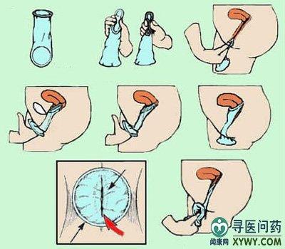 大多数人在使用外用安全措施的时候都习惯于男用避孕套,但是现在的