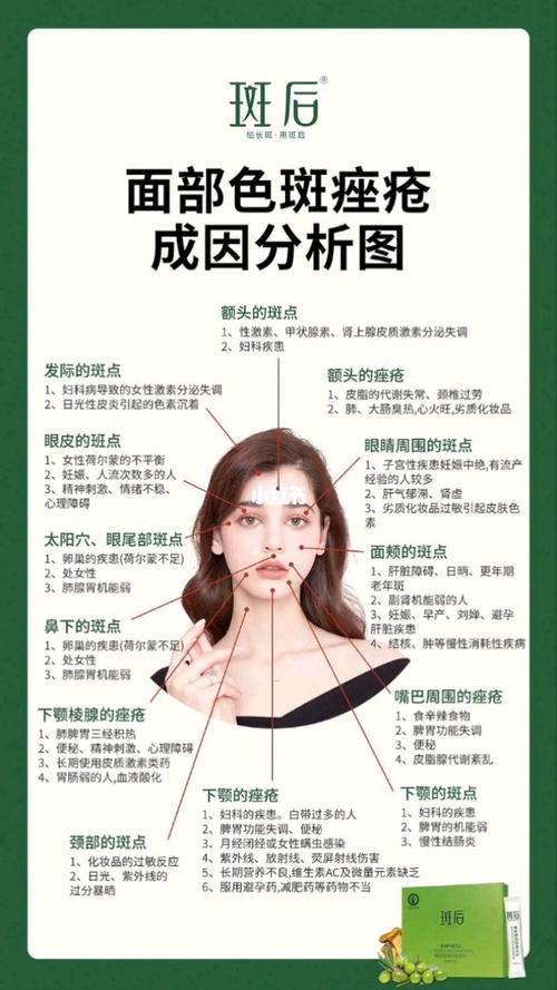 面部色斑成因分析图959595 你掌握了多少60_祛痘_祛斑_祛斑