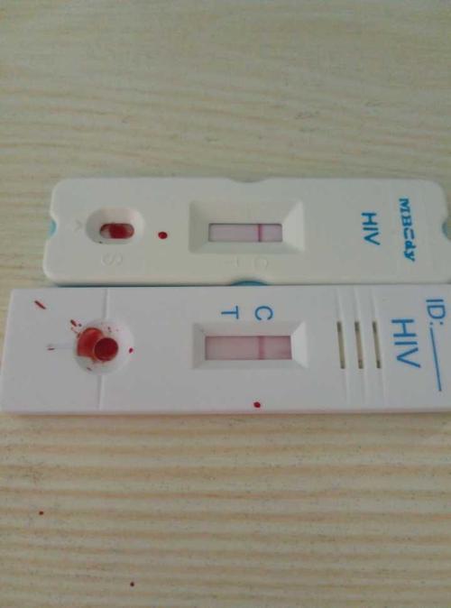 普通人到底如何检测是否艾滋病(hiv)?