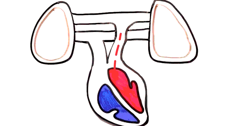但危害并没有止于肺泡,pm2.5家族中更有一种刀锋战士pm0.