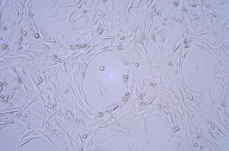 f12 10�s 气相:空气,95%;二氧化碳,5% 温度:37℃ 40x光镜下图片
