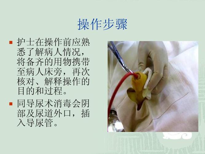 留置导尿术ppt