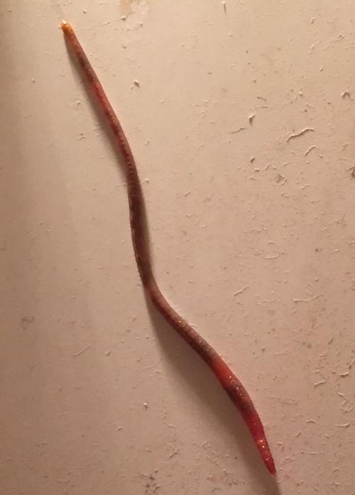 请问这个是什么虫子,出现好几次了,是血吸虫吗?