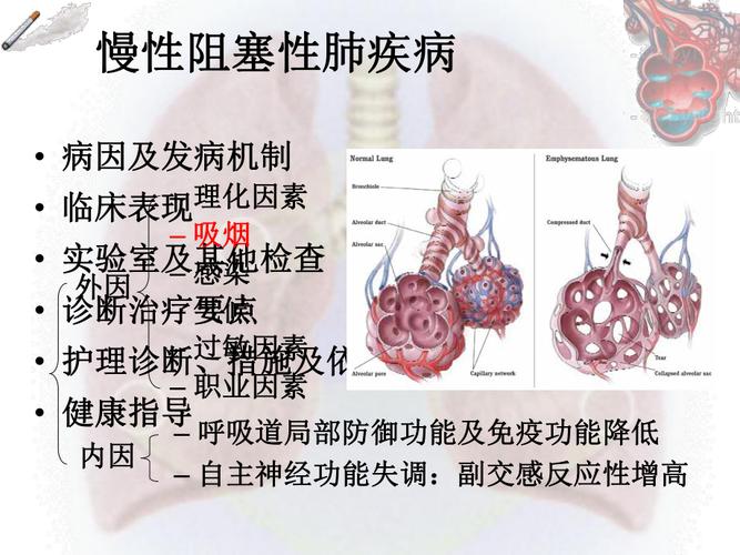 慢性阻塞性肺疾病