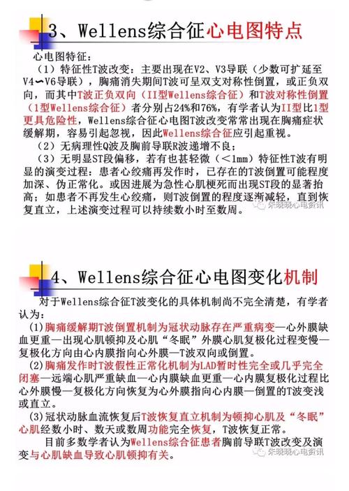 wellen"s综合症,yamaguchi综合症,brugada综合症,短qt综合症,de