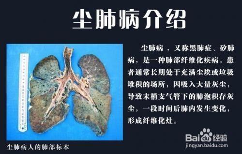 尘肺病黑板报 黑板报图片素材
