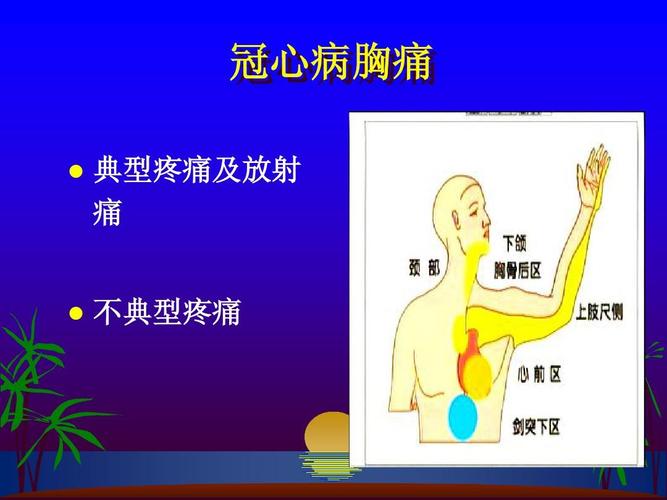冠心病胸痛   典型疼痛及放射 痛 不典型疼痛