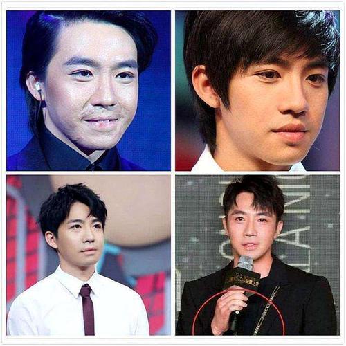 俞灏明术后修复成功, 再次登上颜值巅峰, 网友: 帅过蔡徐坤!